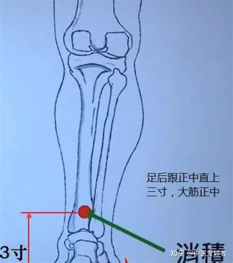 消積穴|醫砭 » 經穴庫 » 消濼